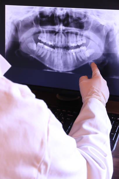 Best Emergency Dentist for Knocked-Out Tooth in Surf City, NJ