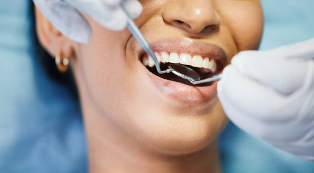 Best Broken or Cracked Tooth Emergency Dentist in Surf City, NJ
